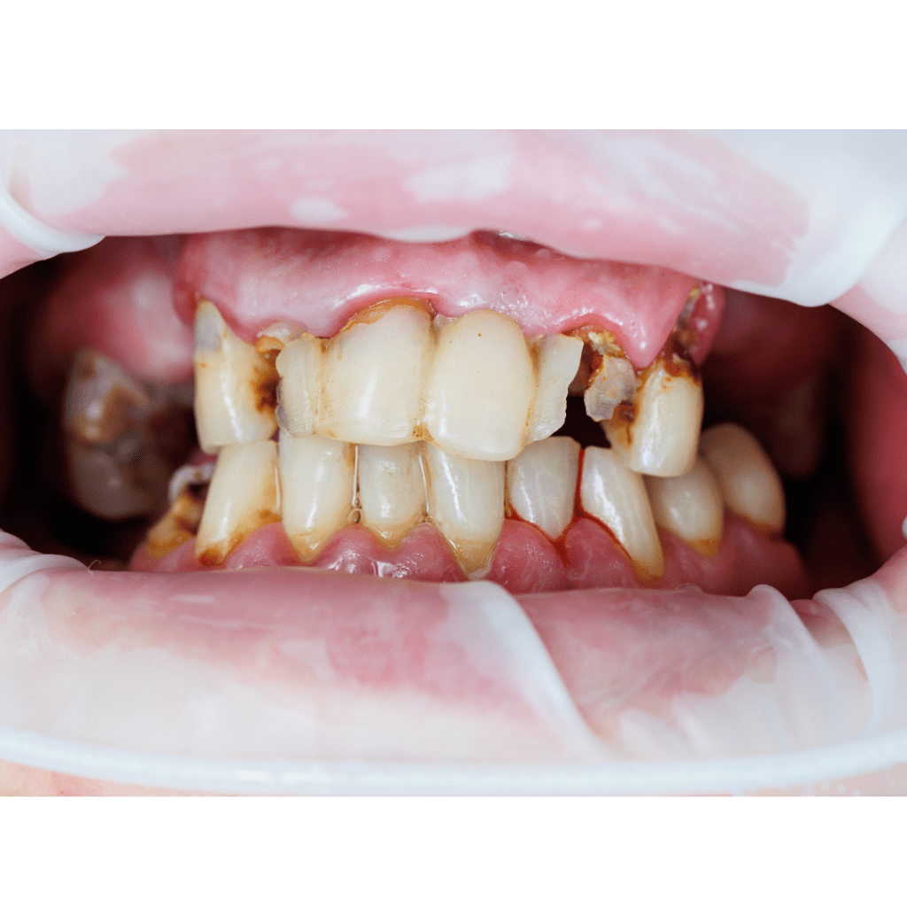 match mouth blog