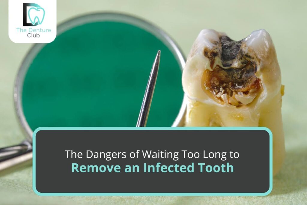 The-Dangers-of-Waiting-Too-Long-to-Remove-an-Infected-Tooth.jpg