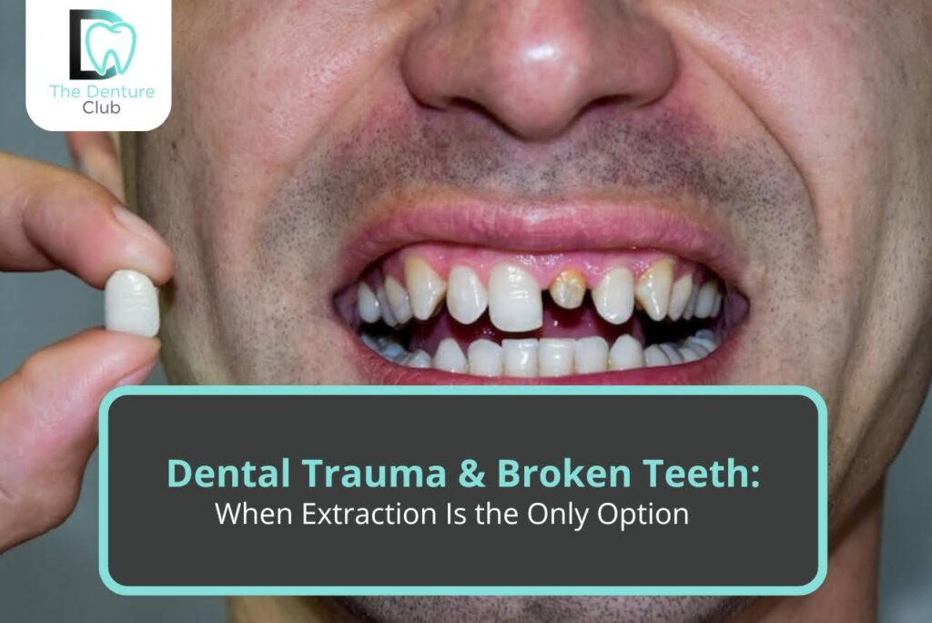 Dental Trauma & Broken Teeth: When Extraction Is the Only Option