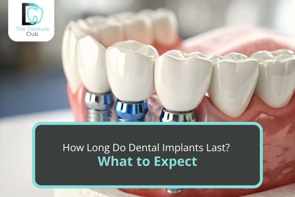 Dental Implants