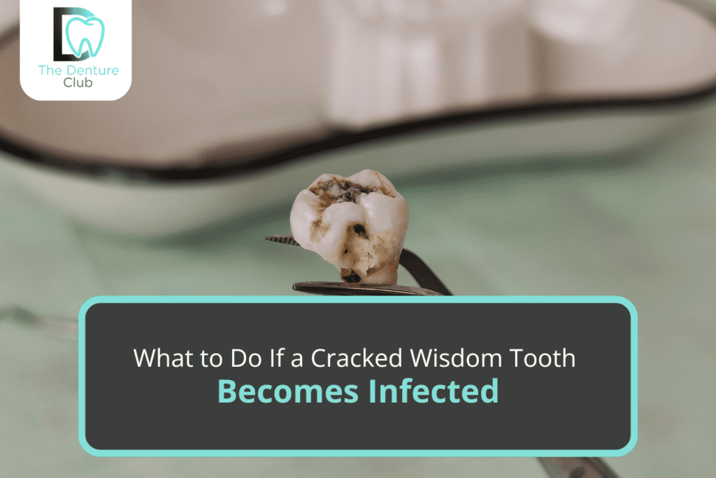 Cracked Wisdom Tooth